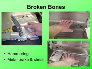 Broken Bones
• Hammering
• Metal brake & shear
 