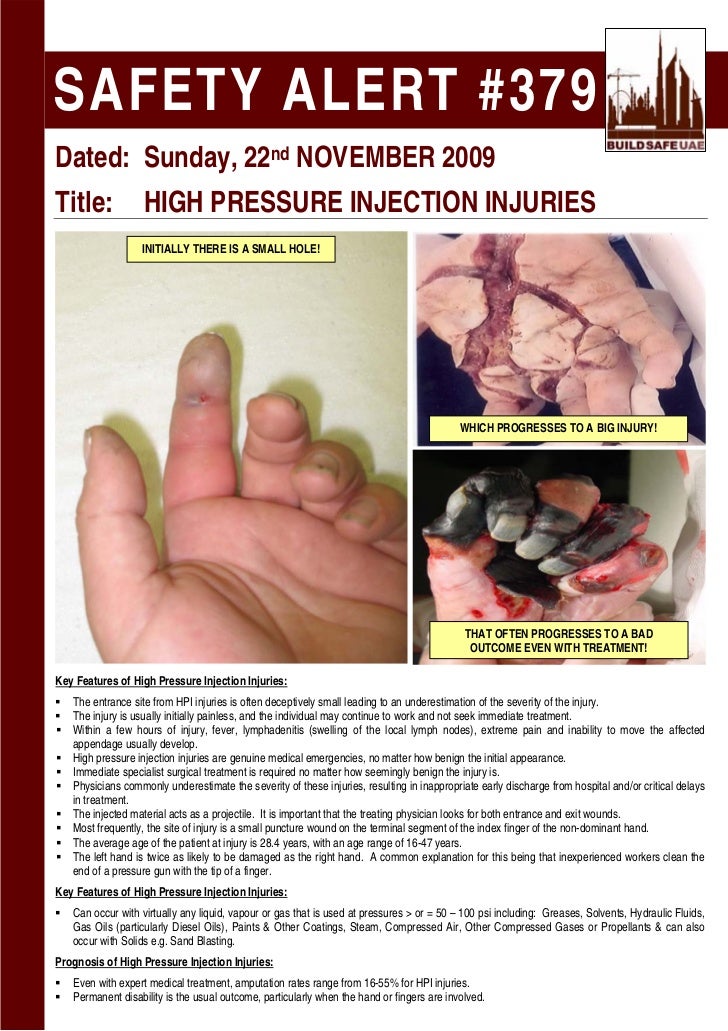 Safety Alert High Pressure Injection Injuries