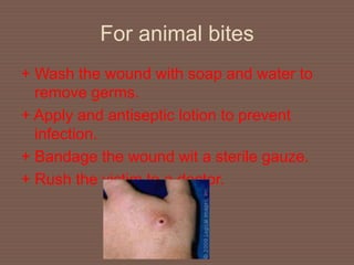 For animal bites
+ Wash the wound with soap and water to
remove germs.
+ Apply and antiseptic lotion to prevent
infection.
+ Bandage the wound wit a sterile gauze.
+ Rush the victim to a doctor.
 