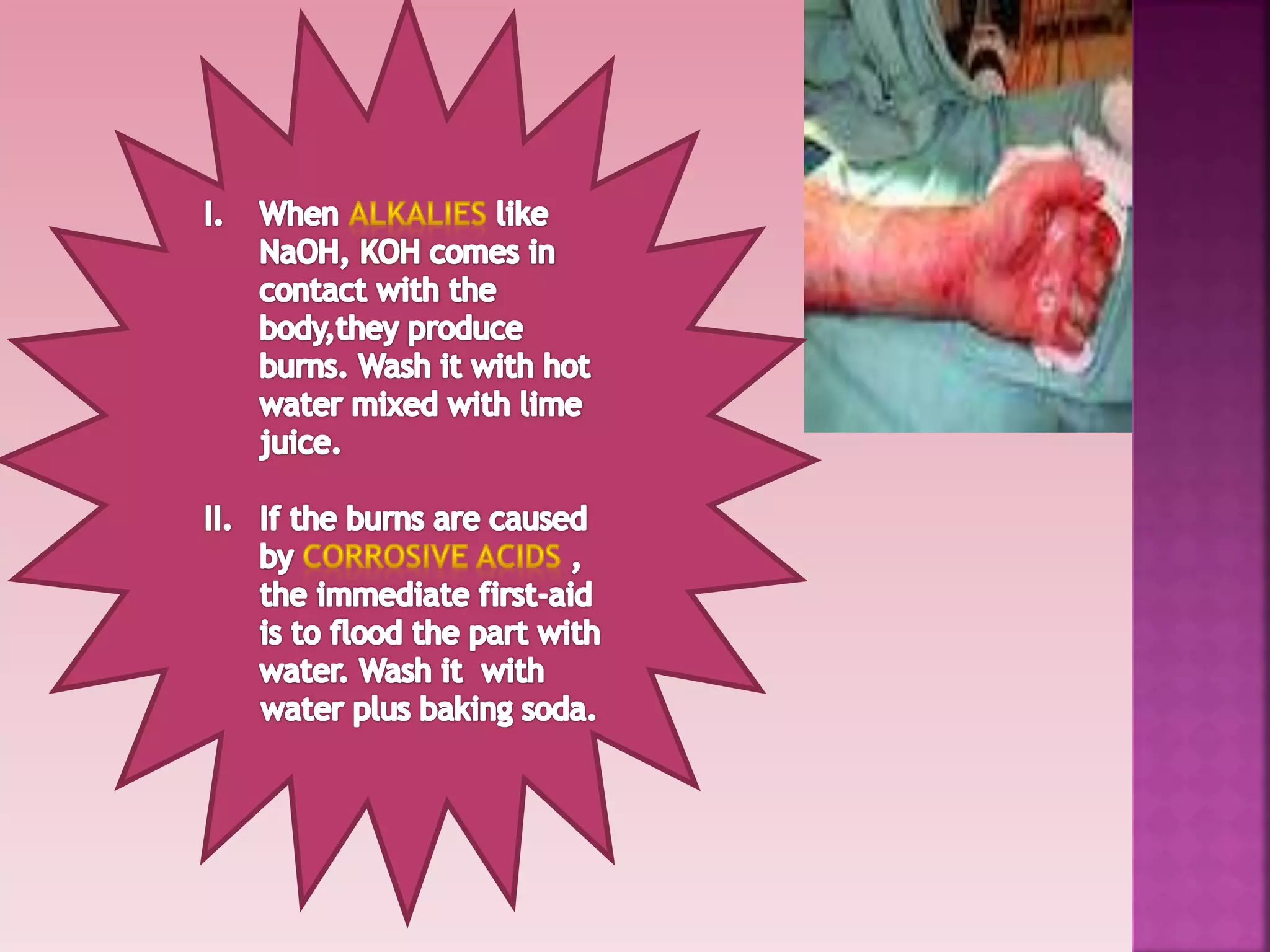 Safety and first aid