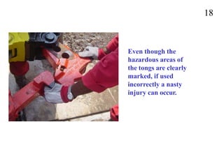 18
Even though the
hazardous areas of
the tongs are clearly
marked, if used
incorrectly a nasty
injury can occur.
 