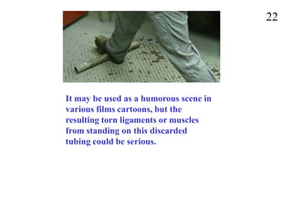 22
It may be used as a humorous scene in
various films cartoons, but the
resulting torn ligaments or muscles
from standing on this discarded
tubing could be serious.
 