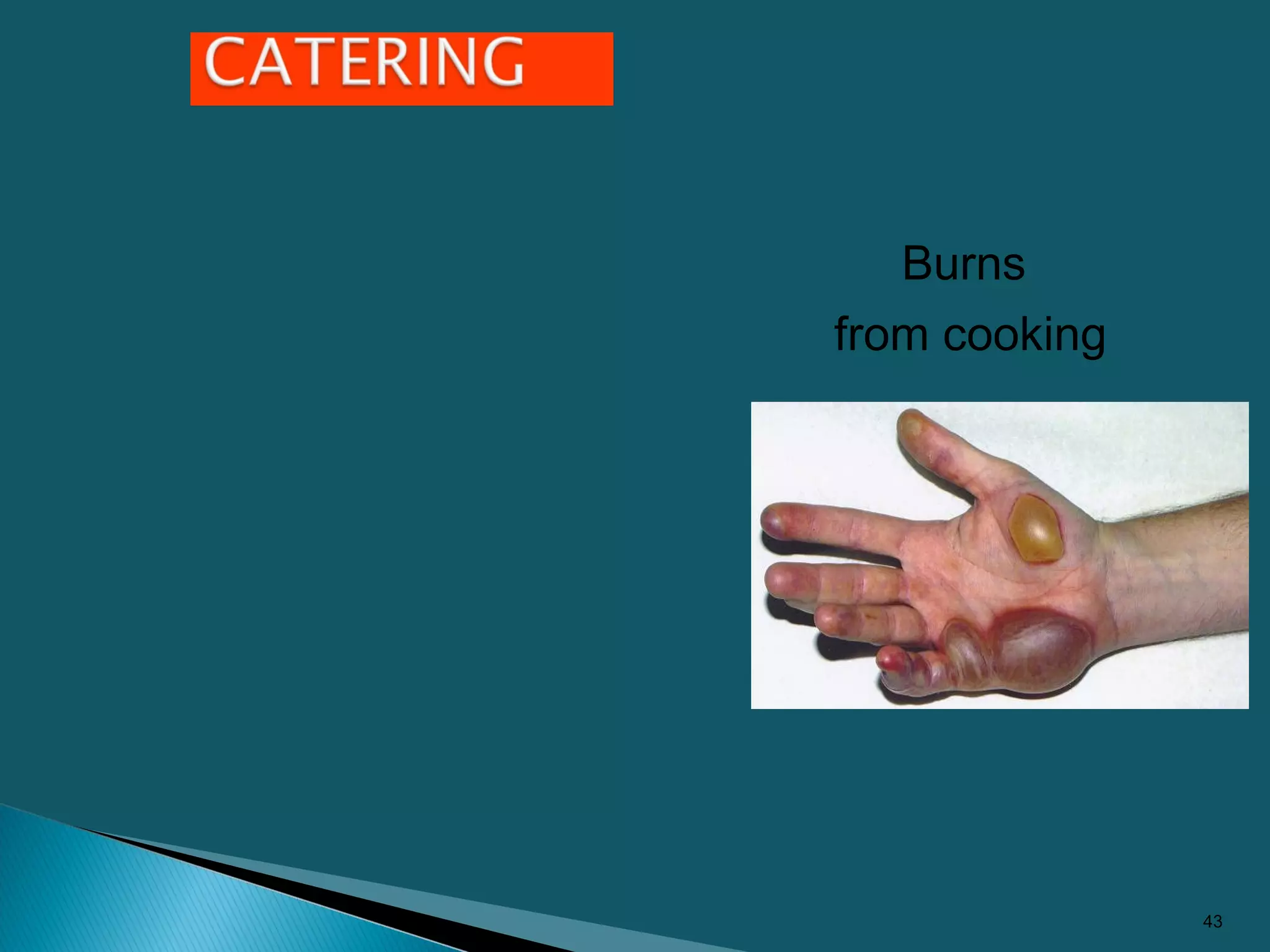 Burns
from cooking
43
 