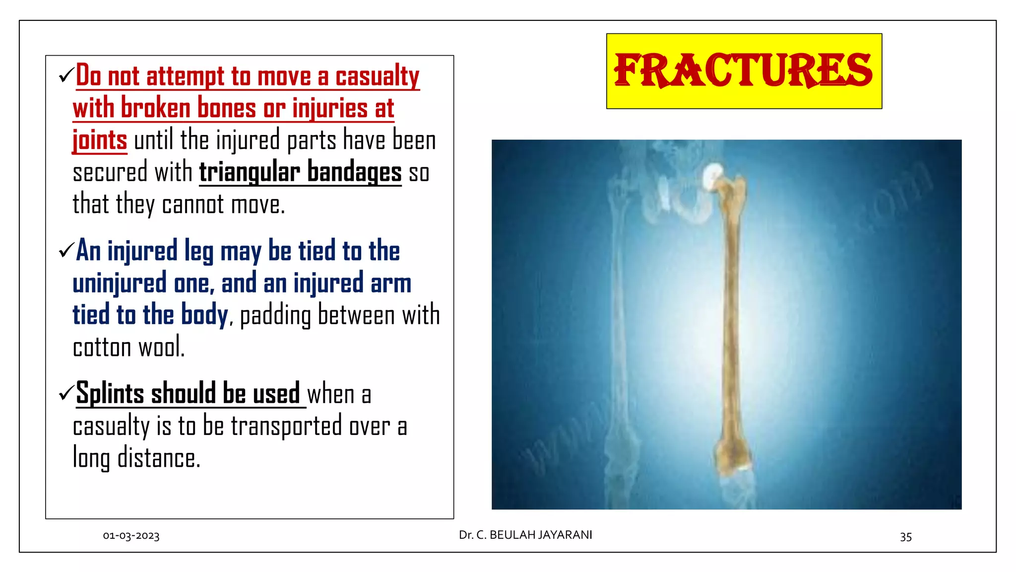 Fractures
Do not attempt to move a casualty
with broken bones or injuries at
joints until the injured parts have been
secured with triangular bandages so
that they cannot move.
An injured leg may be tied to the
uninjured one, and an injured arm
tied to the body, padding between with
cotton wool.
Splints should be used when a
casualty is to be transported over a
long distance.
01-03-2023 35
Dr.C. BEULAH JAYARANI
 