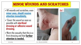 Minor wounds and scratches
All wounds and scratches, even
minor ones, should receive
attention immediately.
 Cover the wound as soon as
possible with sterilized
dressing or adhesive wound
dressing.
Warn the casualty that this is a
first dressing and that further
attention is needed.
01-03-2023 21
Dr.C. BEULAH JAYARANI
 