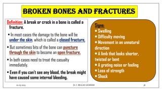 Broken bones and fractures
Definition: A break or crack in a bone is called a
fracture.
• In most cases the damage to the bone will be
under the skin, which is called a closed fracture,
• But sometimes bits of the bone can puncture
through the skin to become an open fracture.
• In both cases need to treat the casualty
immediately.
• Even if you can't see any blood, the break might
have caused some internal bleeding.
Signs:
• Swelling
• Difficulty moving
• Movement in an unnatural
direction
• A limb that looks shorter,
twisted or bent
• A grating noise or feeling
• Loss of strength
• Shock
01-03-2023 36
Dr.C. BEULAH JAYARANI
 