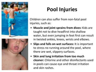 Pool Injury Safety for Children | PPTX