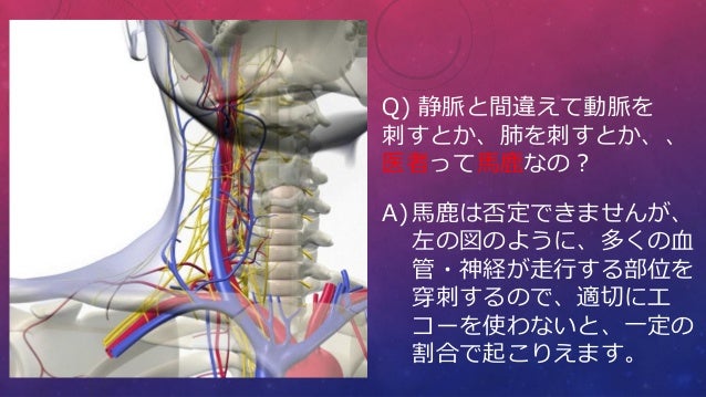 中心静脈カテーテル挿入 管理における安全体制の確立 中心静脈カテーテル挿入 管理における安全体制の確立