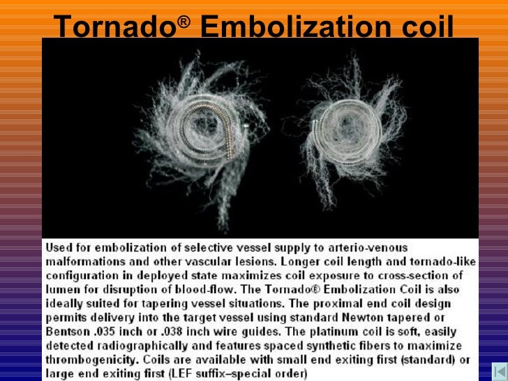 MRI Safety In Patients With Implanted CV Devices Sanjoy Sanyal