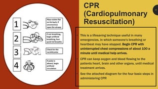 CPR
(Cardiopulmonary
Resuscitation)
• This is a lifesaving technique useful in many
emergencies, in which someone's breathing or
heartbeat may have stopped. Begin CPR with
uninterrupted chest compressions of about 100 a
minute until medical help arrives.
• CPR can keep oxygen and blood flowing to the
patients heart, brain and other organs, until medical
treatment arrives.
• See the attached diagram for the four basic steps in
administering CPR
11
 