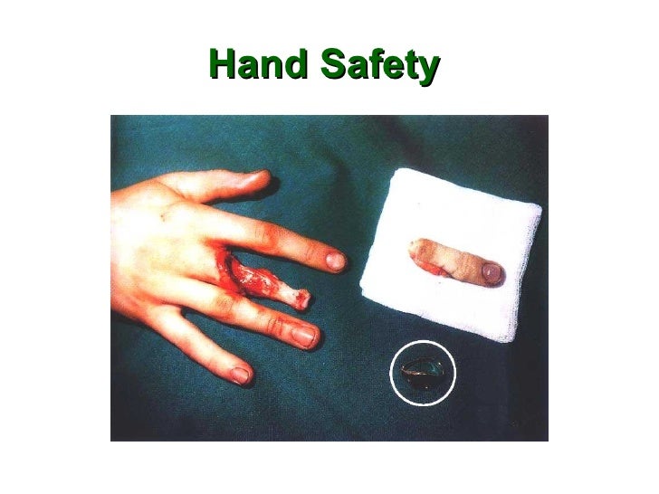 Safety training {do not wear a ring while working}