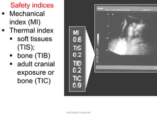 Mi Index ultrasound safety | PDF