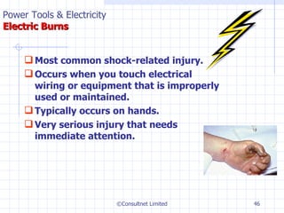 Most common shock-related injury. Occurs when you touch electrical wiring or equipment that is improperly used or maintained. Typically occurs on hands. Very serious injury that needs  immediate attention. ©Consultnet Limited Power Tools & Electricity   Electric Burns 
