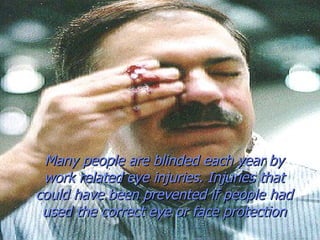 ©Consultnet Limited Many people are blinded each year by work related eye injuries. Injuries that could have been prevented if people had used the correct eye or face protection 