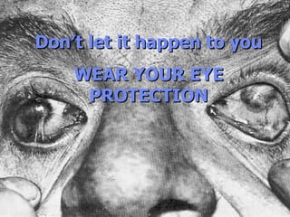 ©Consultnet Limited Don’t let it happen to you  WEAR YOUR EYE PROTECTION 