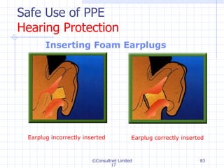 Safe Use of PPE Hearing Protection Inserting Foam Earplugs   ©Consultnet Limited Earplug incorrectly inserted Earplug correctly inserted 17 