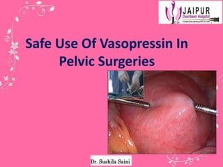 Safe Use Of Vasopressin In
Pelvic Surgeries
 