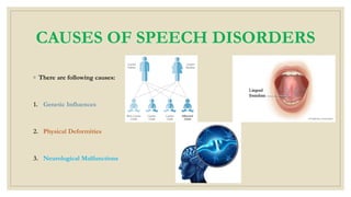 CAUSES OF SPEECH DISORDERS
◦ There are following causes:
1. Genetic Influences
2. Physical Deformities
3. Neurological Malfunctions
 