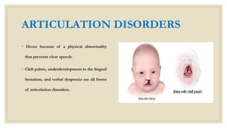ARTICULATION DISORDERS
◦ Occur because of a physical abnormality
that prevents clear speech.
◦ Cleft palate, underdevelopment in the lingual
frenulum, and verbal dyspraxia are all forms
of articulation disorders.
 