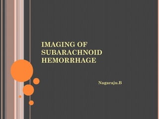 IMAGING OF
SUBARACHNOID
HEMORRHAGE
Nagaraju.B
 