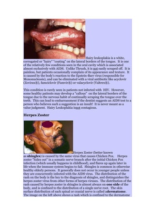 Hairy leukoplakia is a white,
corrugated or "hairy" "coating" on the lateral borders of the tongue. It is one
of the relatively few conditions seen in the oral cavity which is associated
almost exclusively with AIDS. Unlike Thrush, it is not easily scraped off. It is
painless, but patients occasionally complain of its appearance and texture. It
is caused by the body's reaction to the Epstein-Barr virus (responsible for
Mononucleosis), and can be eliminated with a viral antibiotic like acyclovir
(Zovirax®), famciclovir (Famvir®) or valacyclovir (Valtrex®).
This condition is rarely seen in patients not infected with HIV. However,
some healthy patients may develop a "callous" on the lateral borders of the
tongue due to the nervous habit of continually scraping the tongue over the
teeth. This can lead to embarrassment if the dentist suggests an AIDS test to a
person who believes such a suggestion is an insult! It is never meant as a
value judgment. Hairy Leukoplakia isnot contagious.
Herpes Zoster
Herpes Zoster (better known
as shingles) is caused by the same virus that causes Chicken Pox. Herpes
zoster "hides out" in a somatic nerve branch after the initial Chicken Pox
infection (which usually happens in childhood), and flares up again later in
life when the immune system begins to fail. Shingles is common in otherwise
healthy elderly persons. It generally does not occur in younger people unless
they are concurrently infected with the AIDS virus. The distribution of the
rash on the body is the key to the diagnosis of shingles, and distinguishes the
herpes zoster virus from other forms of herpes viruses. The distribution of the
rash caused by herpes zoster in shingles is almost always on one side of the
body, and is confined to the distribution of a single nerve root. The skin
surface distribution of each spinal or cranial nerve is called adermatome.
The image on the left above shows a rash which is confined to the dermatome
 