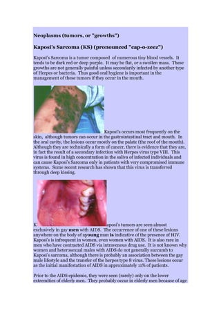 Neoplasms (tumors, or "growths")
Kaposi's Sarcoma (KS) (pronounced "cap-o-zeez")
Kaposi's Sarcoma is a tumor composed of numerous tiny blood vessels. It
tends to be dark red or deep purple. It may be flat, or a swollen mass. These
growths are not generally painful unless secondarily infected by another type
of Herpes or bacteria. Thus good oral hygiene is important in the
management of these tumors if they occur in the mouth.
Kaposi's occurs most frequently on the
skin, although tumors can occur in the gastrointestinal tract and mouth. In
the oral cavity, the lesions occur mostly on the palate (the roof of the mouth).
Although they are technically a form of cancer, there is evidence that they are,
in fact the result of a secondary infection with Herpes virus type VIII. This
virus is found in high concentration in the saliva of infected individuals and
can cause Kaposi's Sarcoma only in patients with very compromised immune
systems. Some recent research has shown that this virus is transferred
through deep kissing.
K aposi's tumors are seen almost
exclusively in gay men with AIDS. The occurrence of one of these lesions
anywhere on the body of ayoung man is indicative of the presence of HIV.
Kaposi's is infrequent in women, even women with AIDS. It is also rare in
men who have contracted AIDS via intravenous drug use. It is not known why
women and heterosexual males with AIDS do not generally succumb to
Kaposi's sarcoma, although there is probably an association between the gay
male lifestyle and the transfer of the herpes type 8 virus. These lesions occur
as the initial manifestation of AIDS in approximately 11% of patients.
Prior to the AIDS epidemic, they were seen (rarely) only on the lower
extremities of elderly men. They probably occur in elderly men because of age
 