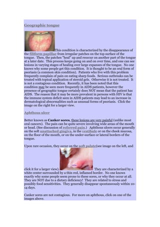 Geographic tongue
This condition is characterized by the disappearance of
the filiform papillae from irregular patches on the top surface of the
tongue. Then, the patches "heal" up and reoccur on another part of the tongue
at a later date. This process keeps going on and on over time, and one can see
lesions in varying stages of healing over large expanses of the tongue. No one
knows why some people get this condition. It is thought to be an oral form of
psoriasis (a common skin condition). Patients who live with this problem
frequently complain of pain on eating sharp foods. Serious outbreaks can be
treated with topical application of steroid gels. Otherwise it is not treated. It
is not a contagious condition. Recently, it has been noted that this
condition may be seen more frequently in AIDS patients, however the
presence of geographic tongue certainly does NOT mean that the patient has
AIDS. The reason that it may be more prevalent in persons with HIV is that
the immune system deficit seen in AIDS patients may lead to an increase in
dermatological abnormalities such as unusual forms of psoriasis. Click the
image on the right for a larger view.
Aphthous ulcer
Better known as Canker sores, these lesions are very painful (unlike most
oral cancers). The pain can be quite severe involving wide areas of the mouth
or head. (See discussion of referred pain.) Aphthous ulcers occur generally
on the soft unattached gingiva, in the vestibule or on the cheek mucosa,
on the floor of the mouth, or on the under-surface or lateral borders of the
tongue.
Upon rare occasion, they occur on the soft palate(see image on the left, and
click it for a larger view). They are characterized by a
white center surrounded by a thin red, inflamed border. No one knows
exactly why some people seem prone to these sores, or why they occur at all.
They are NOT due to a dietary deficiency! They are related to stress and
possibly food sensitivities. They generally disappear spontaneously within 10-
14 days.
Canker sores are not contagious. For more on aphthous, click on one of the
images above.
 