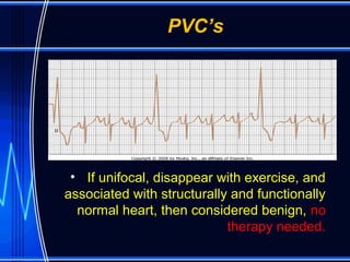 PVC’s
• If unifocal, disappear with exercise, and
associated with structurally and functionally
normal heart, then considered benign, no
therapy needed.
 