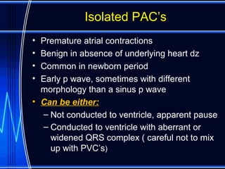 Isolated PAC’sIsolated PAC’s
• Premature atrial contractions
• Benign in absence of underlying heart dz
• Common in newborn period
• Early p wave, sometimes with different
morphology than a sinus p wave
• Can be either:
– Not conducted to ventricle, apparent pause
– Conducted to ventricle with aberrant or
widened QRS complex ( careful not to mix
up with PVC’s)
 