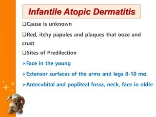 Cause is unknown
Red, itchy papules and plaques that ooze and
crust
Sites of Predilection
Face in the young
Extensor surfaces of the arms and legs 8-10 mo.
Antecubital and popliteal fossa, neck, face in older
Infantile Atopic Dermatitis
 