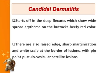 Starts off in the deep flexures which show wide
spread erythema on the buttocks-beefy red color.
There are also raised edge, sharp marginization
and white scale at the border of lesions, with pin
point pustulo-vesicular satellite lesions
Candidal Dermatitis
 