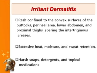 Rash confined to the convex surfaces of the
buttocks, perineal area, lower abdomen, and
proximal thighs, sparing the intertriginous
creases.
Excessive heat, moisture, and sweat retention.
Harsh soaps, detergents, and topical
medications
Irritant Dermatitis
 