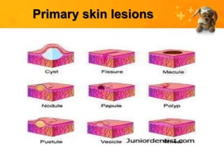 Primary skin lesions
 