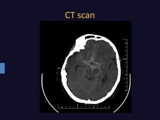 CT scan
 