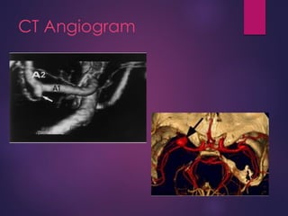 CT Angiogram
 
