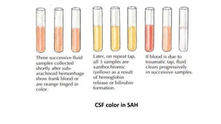 Csf Sample Color Subarachnoid Haemorrhage Management | PPTX