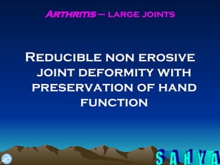 Arthritis  – large joints Reducible non erosive joint deformity with preservation of hand function 