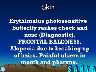 Skin Erythimatus photosensitive butterfly rashes check and nose (Diagnostic). FRONTAL BALDNESS. Alopecia due to breaking up of hairs. Painful ulcers in mouth and pharynx.  