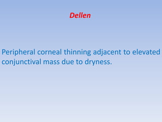 Dellen
Peripheral corneal thinning adjacent to elevated
conjunctival mass due to dryness.
 