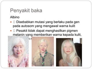 Penyakit baka
Albino
 Disebabkan mutasi yang berlaku pada gen
pada autosom yang mengawal warna kulit
 Pesakit tidak dapat menghasilkan pigmen
melanin yang memberikan warna kepada kulit,
rambut dan mata
 