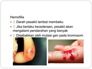 Hemofilia
 Darah pesakit lambat membeku
 Jika berlaku kecederaan, pesakit akan
mengalami pendarahan yang banyak
 Disebabkan oleh mutasi gen pada kromosom
seks X
 