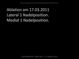 Ablation am 17.03.2011
Lateral 1 Nadelposition.
Medial 1 Nadelposition.
ZIRN.KHNW.FFM · SAINT 2011 · 3.-4. Oktober 2011
E x t r a h e p a t i s c h e M i k r o w e l l e n a b l a t i o n
 