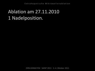 Ablation am 27.11.2010
1 Nadelposition.
ZIRN.KHNW.FFM · SAINT 2011 · 3.-4. Oktober 2011
E x t r a h e p a t i s c h e M i k r o w e l l e n a b l a t i o n
 