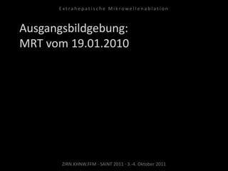 Ausgangsbildgebung:
MRT vom 19.01.2010
ZIRN.KHNW.FFM · SAINT 2011 · 3.-4. Oktober 2011
E x t r a h e p a t i s c h e M i k r o w e l l e n a b l a t i o n
 