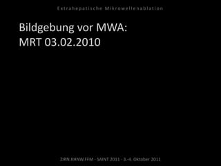 Bildgebung vor MWA:
MRT 03.02.2010
ZIRN.KHNW.FFM · SAINT 2011 · 3.-4. Oktober 2011
E x t r a h e p a t i s c h e M i k r o w e l l e n a b l a t i o n
 
