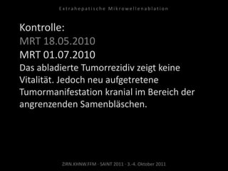 Kontrolle:
MRT 18.05.2010
MRT 01.07.2010
Das abladierte Tumorrezidiv zeigt keine
Vitalität. Jedoch neu aufgetretene
Tumormanifestation kranial im Bereich der
angrenzenden Samenbläschen.
ZIRN.KHNW.FFM · SAINT 2011 · 3.-4. Oktober 2011
E x t r a h e p a t i s c h e M i k r o w e l l e n a b l a t i o n
 