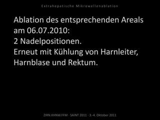Ablation des entsprechenden Areals
am 06.07.2010:
2 Nadelpositionen.
Erneut mit Kühlung von Harnleiter,
Harnblase und Rektum.
ZIRN.KHNW.FFM · SAINT 2011 · 3.-4. Oktober 2011
E x t r a h e p a t i s c h e M i k r o w e l l e n a b l a t i o n
 