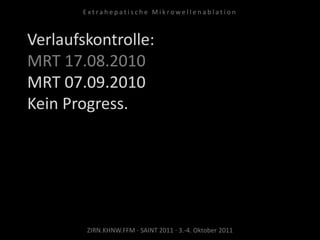 Verlaufskontrolle:
MRT 17.08.2010
MRT 07.09.2010
Kein Progress.
ZIRN.KHNW.FFM · SAINT 2011 · 3.-4. Oktober 2011
E x t r a h e p a t i s c h e M i k r o w e l l e n a b l a t i o n
 