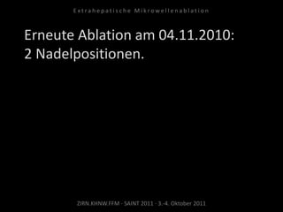 Erneute Ablation am 04.11.2010:
2 Nadelpositionen.
ZIRN.KHNW.FFM · SAINT 2011 · 3.-4. Oktober 2011
E x t r a h e p a t i s c h e M i k r o w e l l e n a b l a t i o n
 
