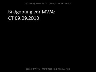 Bildgebung vor MWA:
CT 09.09.2010
ZIRN.KHNW.FFM · SAINT 2011 · 3.-4. Oktober 2011
E x t r a h e p a t i s c h e M i k r o w e l l e n a b l a t i o n
 